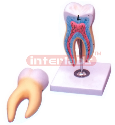 HUMAN LOWER MOLAR WITH ONE ROOT